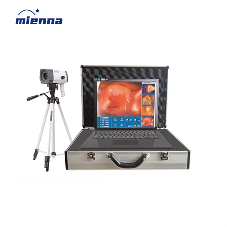 منظار المهبل الرقمي الإلكتروني لجراحة أمراض النساء